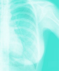 Cancer Is Scary. Getting a Mammogram Doesn't Have To Be Mammogram_opener